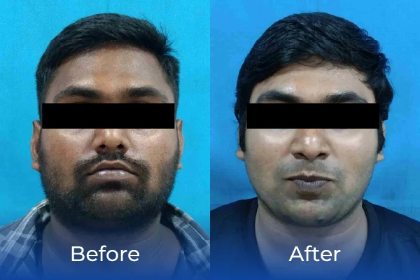 hair treatment specialist